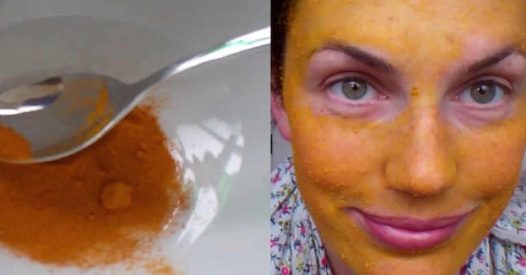 Turmeric Face Mask For Rosacea, Acne, Eczema and Dark Circle - Featured image