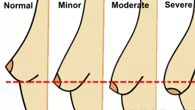 5 Myths About Sagging Breasts and 4 Ways to Stop it From Happening to You - Featured image
