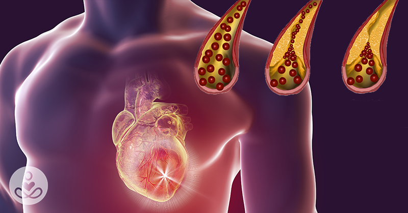 10 Foods That You Should Eat Daily To Help Keep Your Arteries Clean