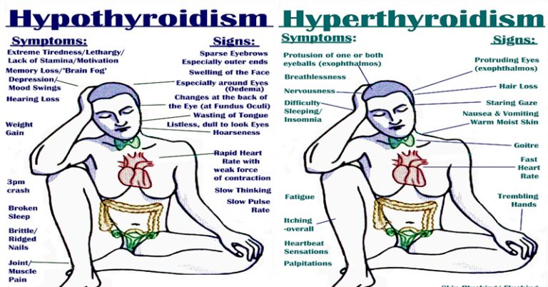 Signs, Symptoms, Triggers, and Natural Approaches to Hypo and Hyperthyroidism  - Featured image