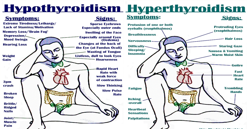Signs, Symptoms, Triggers, and Natural Approaches to Hypo and Hyperthyroidism 