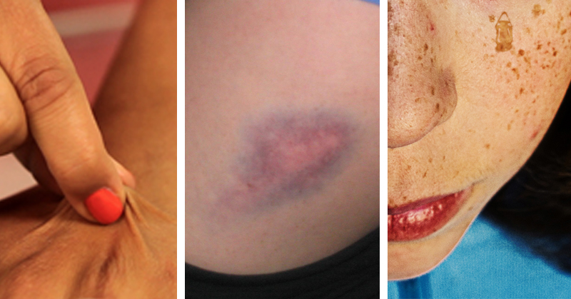5 Minor Signs That Something is Majorly Wrong With Your Body