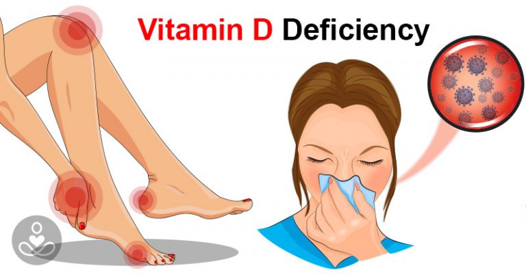 Signs You’re Lacking in Vitamin D and How to Get More To Boost Your Immunity - Featured image