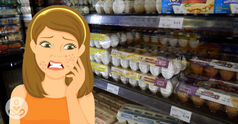 How to Get Rid of Acne Naturally: 3 Types of Food to Avoid - Featured image