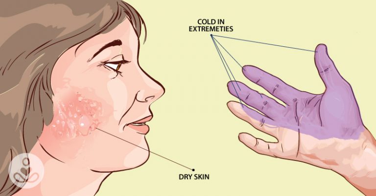 Should You Get Your Thyroid Checked? Here Are 10 Signs of Hypothyroidism - Featured image