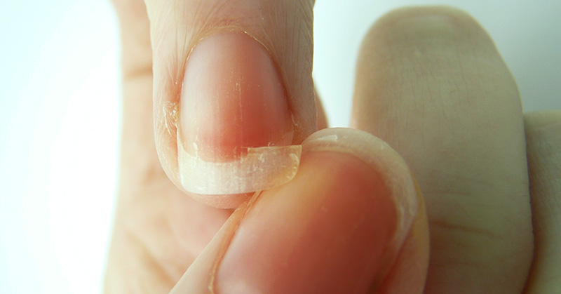 Brittle Nails? Poor Sleep? Start Eating More Of These Foods Immediately