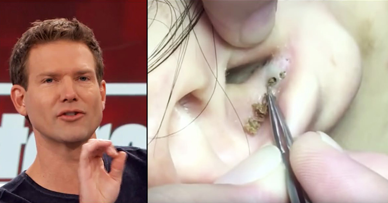 Doctors Warn: Wearing Headphones Too Long Could Cause Blackheads In Ear