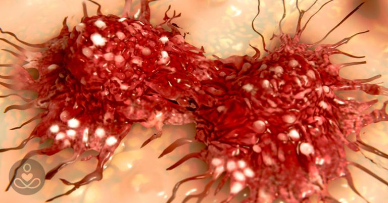 How Do Our Emotions Effect Cancer Growth?  - Featured image