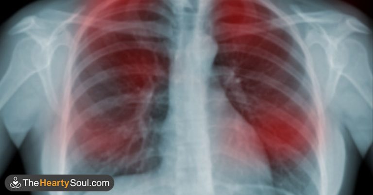 20 Early Signs Your Body is Fighting Cancer - Featured image