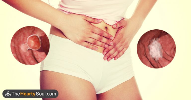 5 Unusual Signs Of Colon Cancer People Accidentally Ignore For Years - Featured image