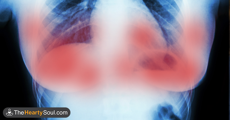 Scientists in Amsterdam destroyed breast cancer tumors in 11 days without chemo