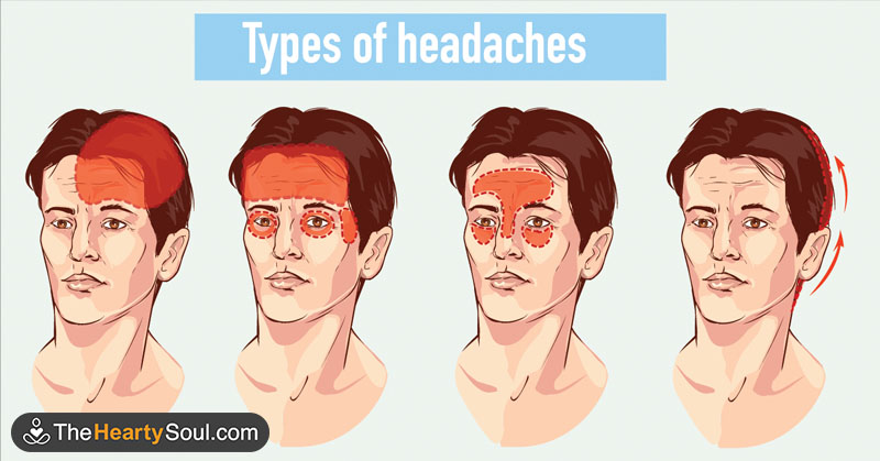8 Surprising Triggers You Didn’t Know Were Causing You Headaches - Featured image