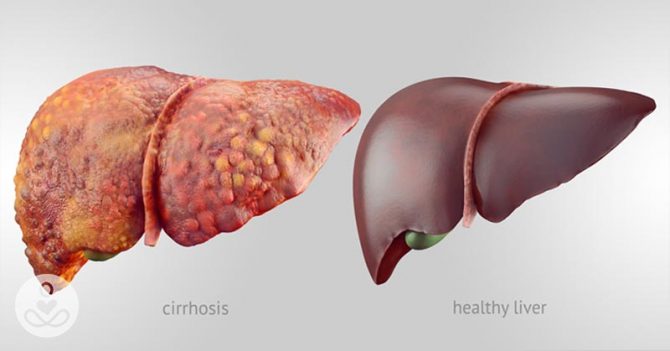 liver-health