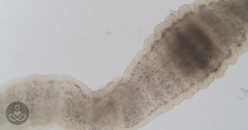 Sushi Tapeworm Measured At Over 5 Feet Long Is An Eye Opener