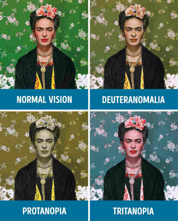 Kinds of Color Blindness - Normal Vision - Deuteranomalia - Protanopia - Tritanopia | Frida Kahlo