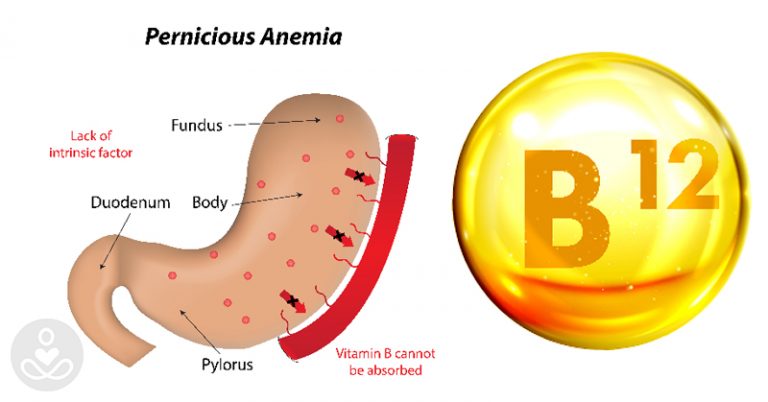 7 symptoms of B12 deficiency that you should never ignore - Featured image