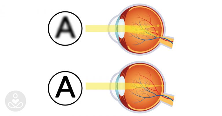 10 simple and relaxing eye exercises you should do after looking at a screen - Featured image