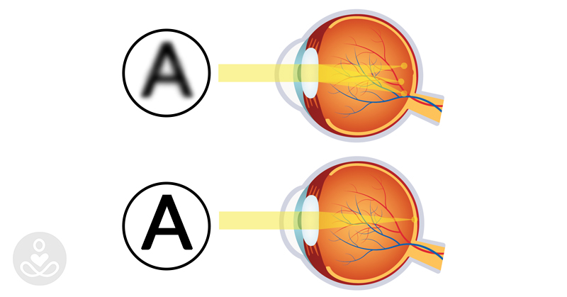 10 simple and relaxing eye exercises you should do after looking at a screen