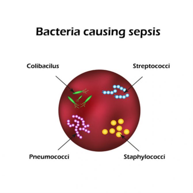 sepsis causes