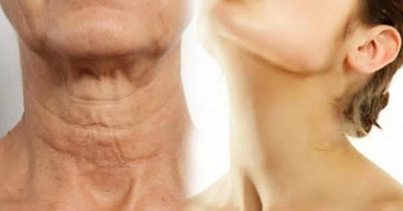 11 Scientific Ways To Get Rid Of Wrinkles That Every Woman Needs to Know
