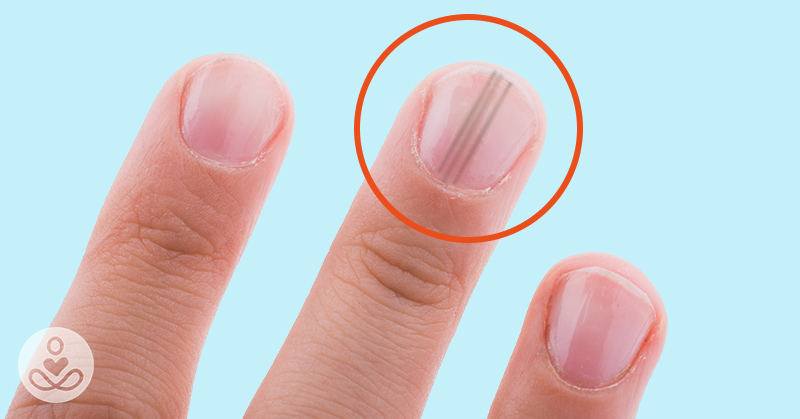 What Does Skin Cancer Look Like? Watch Out For These 7 Symptoms