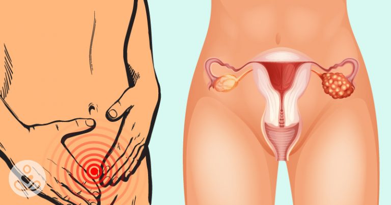 There’s One Way To Check For Ovarian Cancer That Nobody Talks About – Here’s Why - Featured image