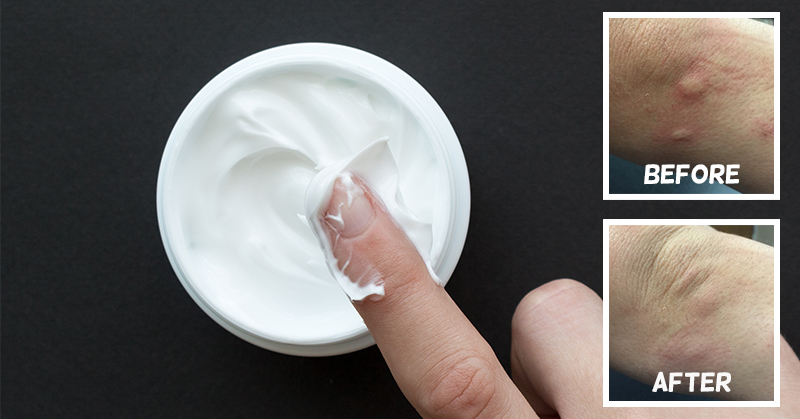 Rub This Peppermint and Baking Soda Mixture Anywhere You Need Relief From Mosquito and Bug Bites