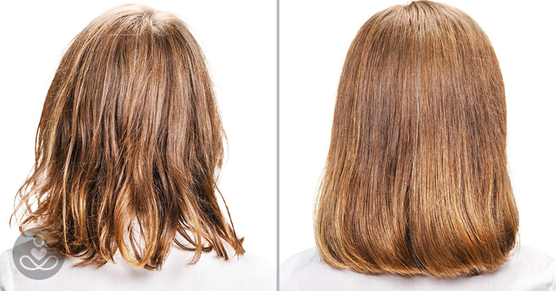 Woman Stops Using Shampoo For 6 Months, This Is What Happened To Her Hair