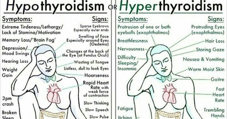 Everything You Need to Know About Every Thyroid Disorder: Signs, Symptoms, Causes, Treatments - Featured image