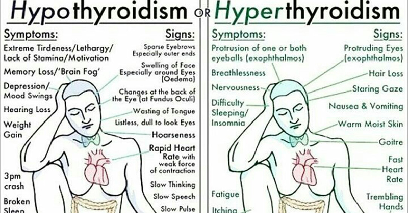 Everything You Need to Know About Every Thyroid Disorder: Signs, Symptoms, Causes, Treatments