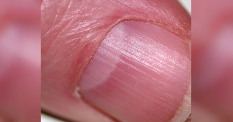 What Is Lunula? Your Lunula, Fingernails, and What They Say About Your Health