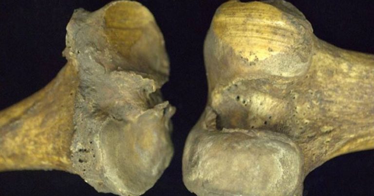 Skeletons Say Osteoarthritis Isn’t About Aging, It’s About Activity - Featured image