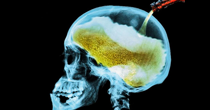 What Alcohol Consumption Does to Your Brain