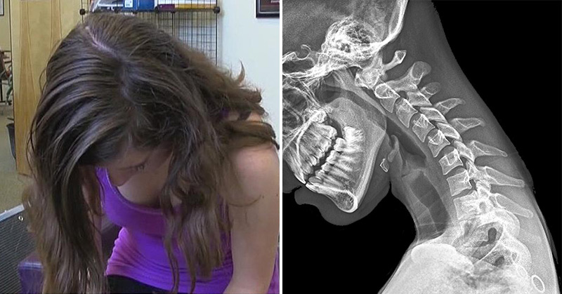 ‘Text Neck’ Is Real: Do These 6 Stretches to Prevent Your Spine from Degeneration