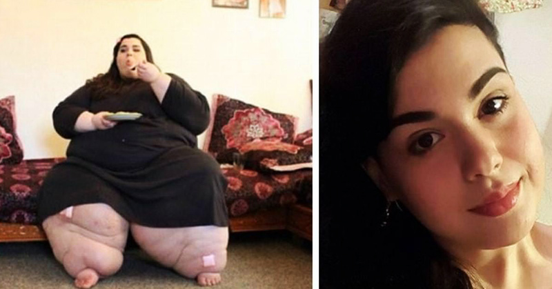 Amber Rachdi’s Incredible ‘My 600 Pound Life’ Weight Loss Transformation