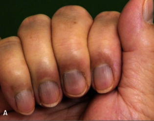 what is lunula