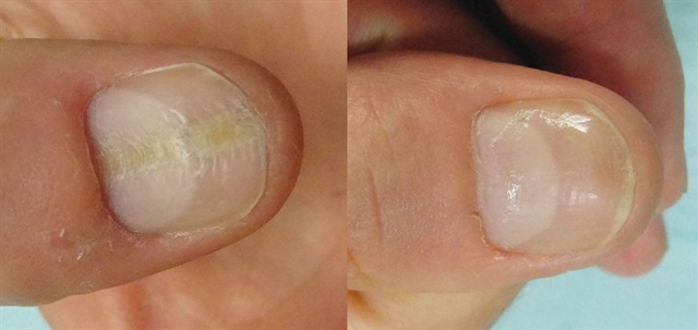 what is lunula