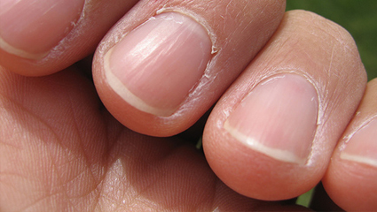 what is lunula