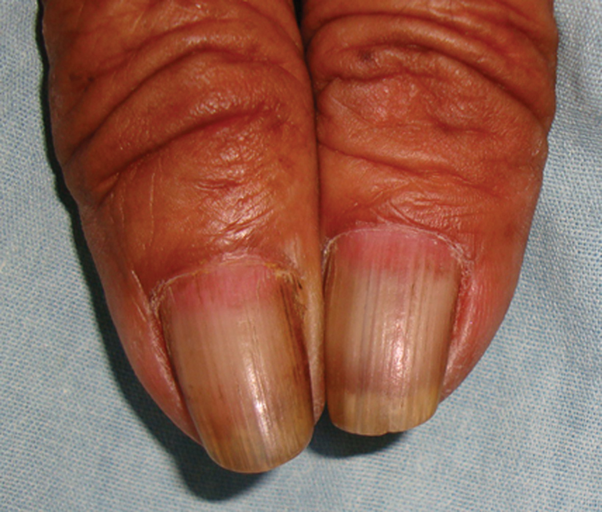 what is lunula