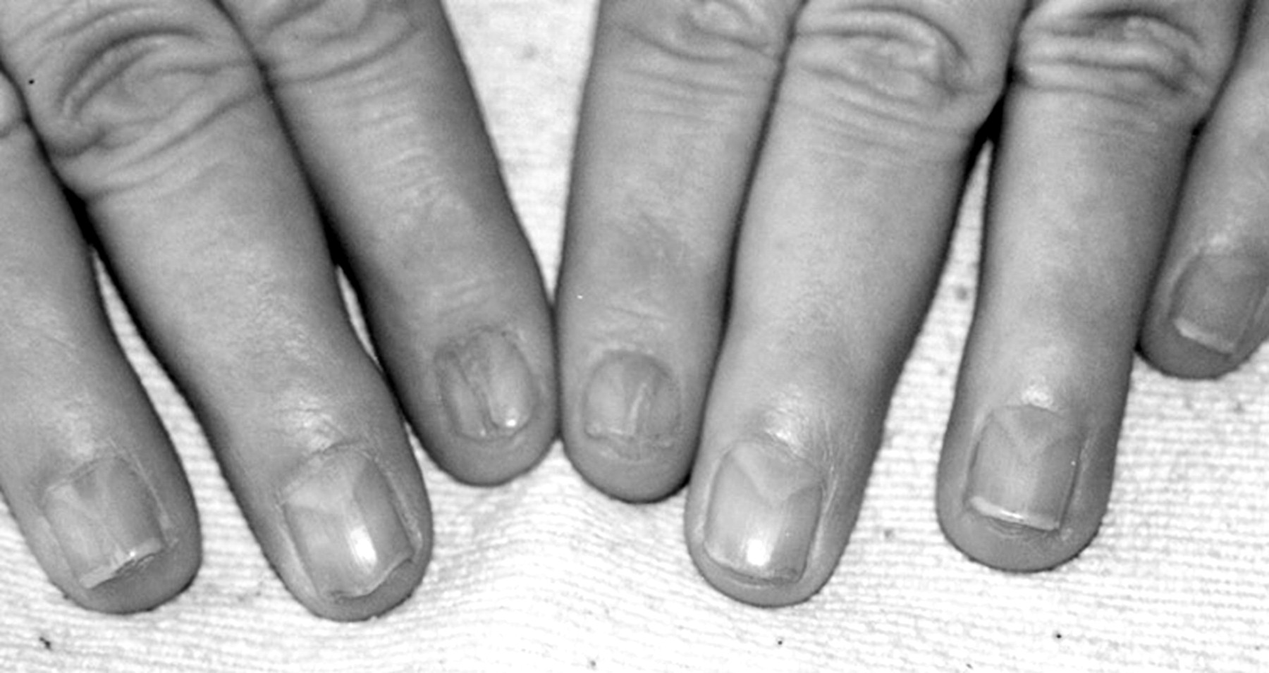 what is lunula
