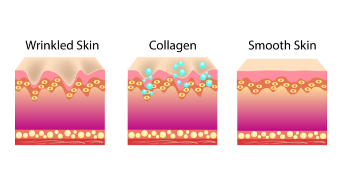 Wrinkled Skin and Smooth Skin Before and After Collagen what causes wrinkles, reverse aging, remove wrinkles, natural anti aging, wrinkle treatment