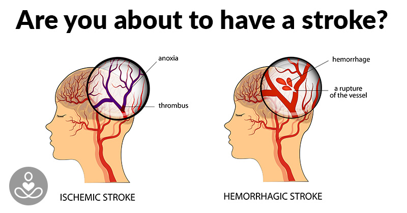 How To Prevent A Stroke Before It’s Too Late