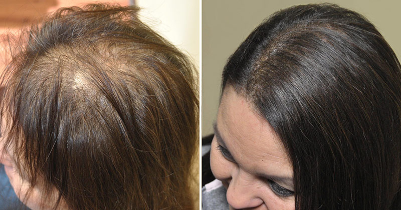 The Best Shampoos for Anyone Who Has Thinning Hair