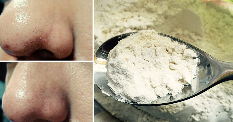 15 Natural Remedies to Help Your Skin Stay Young