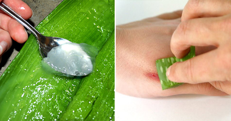 Miracle Medicinal Plant: 17 Ways to Use Aloe Vera for Health and Beauty