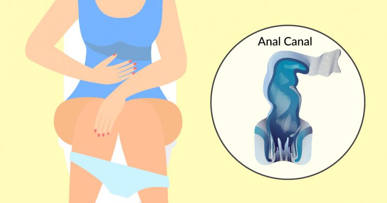 6 early warning signs of Anal Cancer everyone is too embarrassed to talk about