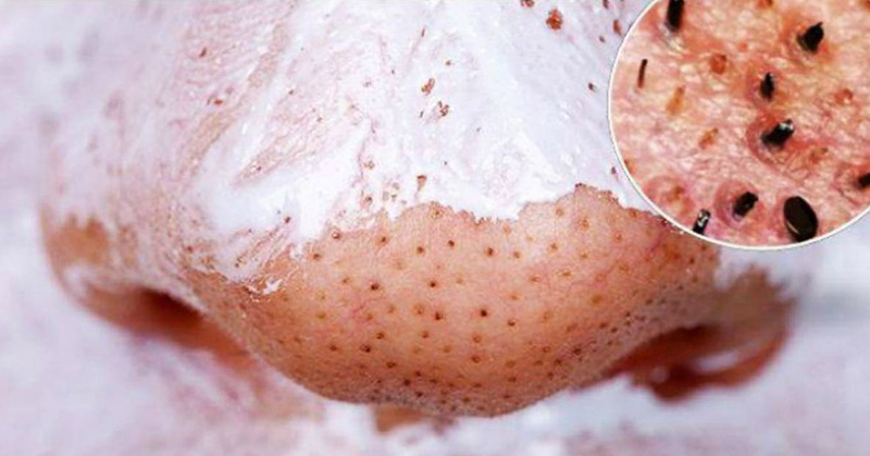 Want better skin? Try this DIY coconut oil baking soda facial cleanser