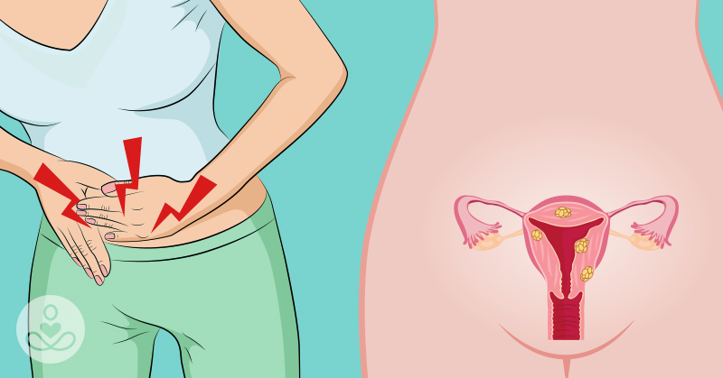 4 Severe Signs of Cervical Cancer You Should Never Ignore, But Many Women Do