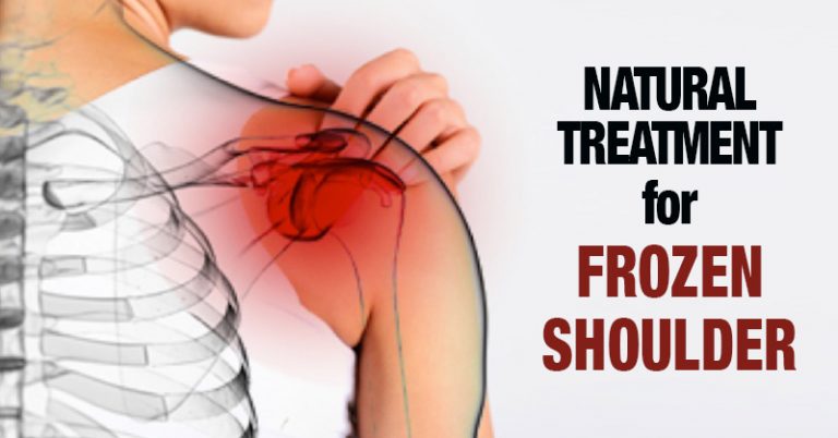 Natural Treatment for Frozen Shoulder and Be Healed Within Days! - Featured image