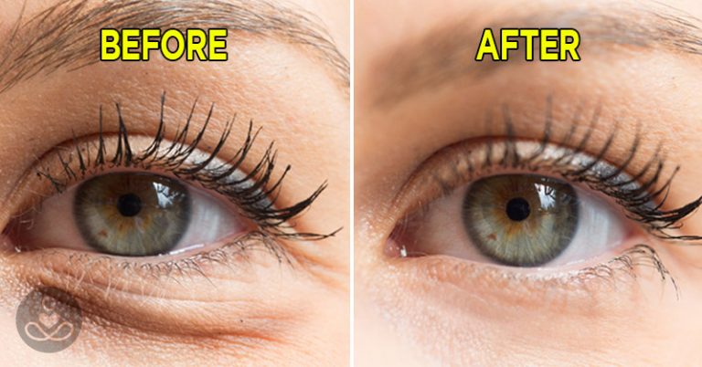 7 Simple Ways to Naturally Reduce Wrinkles - Featured image